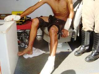 Garoto sofreu ferimentos nos braços, pernas, mãos e pés (Foto: Dourados Informa)