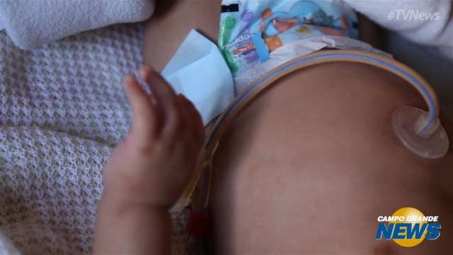 M&atilde;e de beb&ecirc; com microcefalia vai &agrave; Justi&ccedil;a para garantir atendimento