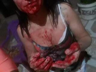 Vítima ensanguentada logo após ser agredida. (Foto: Divulgação / Polícia Civil) 