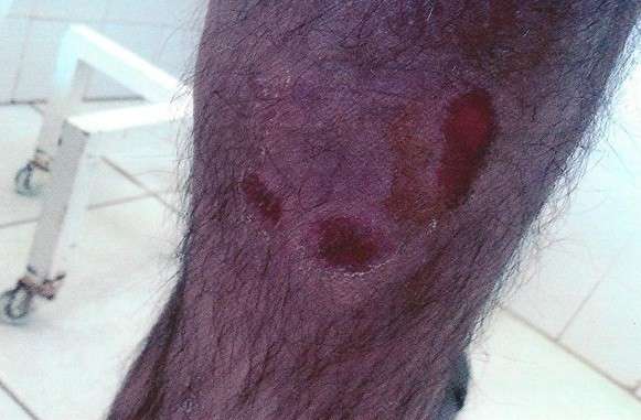 Caso de menino espancado pelo pai por ser gay cria pol&ecirc;mica no Facebook