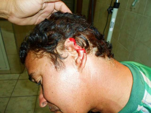 Jovem arranca peda&ccedil;o da orelha do pai durante briga