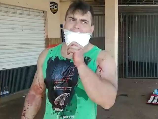 Ciclista &eacute; baleado em atentado perto de condom&iacute;nio na Rua da Divis&atilde;o