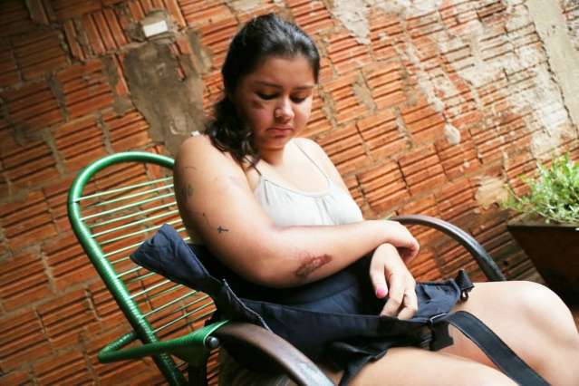 Mesmo sem festa de anivers&aacute;rio, estudante comemora &quot;milagre&quot; de estar viva 