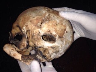 Há uma perfuração no crânio e indícios mostram que a vítima pode ter sido morta há cerca de três anos. (Foto: Divulgação)