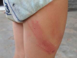 Criança que morava em fazenda de Alcinópolis foi chicoteada nas pernas e nos braços (Foto: Alcinopolis.com)