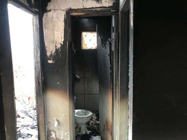 Homem que teve 72% do corpo queimado em inc&ecirc;ndio passa por cirurgia pl&aacute;stica