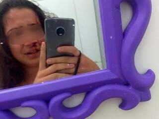 Vítima tirou foto no espelho na casa de agressora depois de sessão de tortura (Foto: Direto das Ruas)
