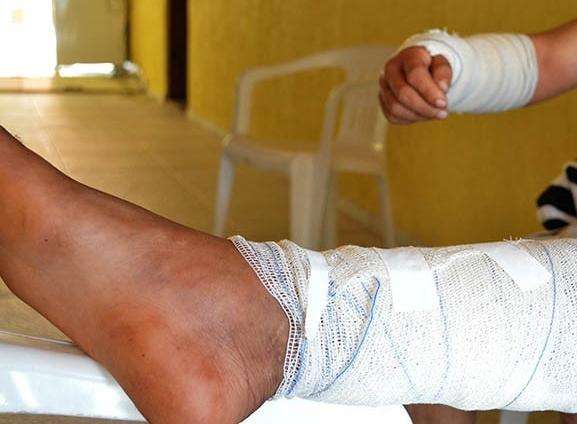 Trabalhadores rurais sobrevivem a ataque de on&ccedil;a-pintada no Pantanal