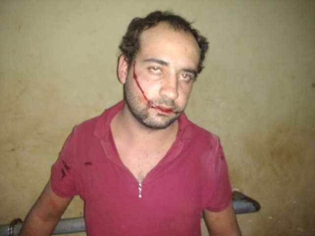 Bandido &eacute; linchado ao ser flagrado tentando furtar caminhonete de m&eacute;dico