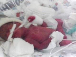 Kauã nasceu com 450 gramas, 25 centímetros e segundo a família foi dado como morto. (Foto: Reprodução/Facebook)