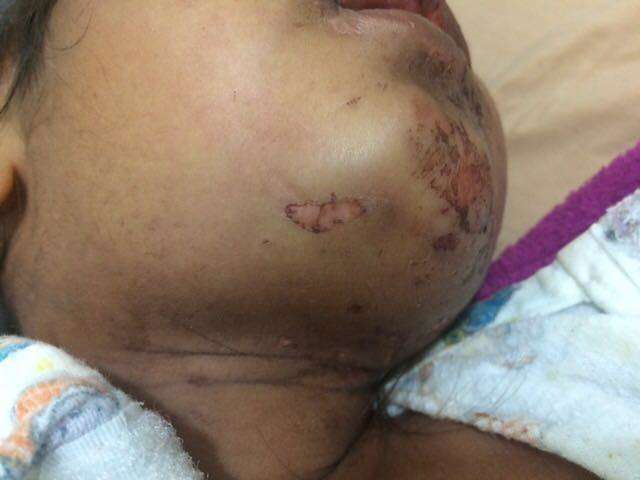 Estuprada e morta, menina de 3 anos estaria sendo agredida h&aacute; 7 meses