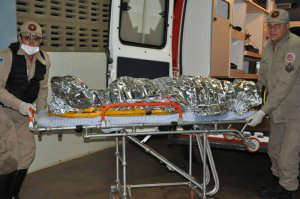  Mulher que teve 80% do corpo queimado morre na Santa Casa