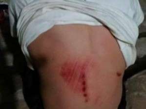 Pai que teria espancado crian&ccedil;a de 10 anos foi ouvido e solto pela pol&iacute;cia