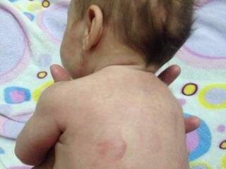 Criança tem hematomas e marcas de mordidas por todo o corpo. (Foto: Direto das Ruas)