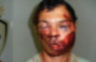 O acusado, Daniel Barbosa, 28 anos, ficou com o rosto totalmente desfigurado devido as agressões. (Foto: Gamarra/ Rio Brilhante News)