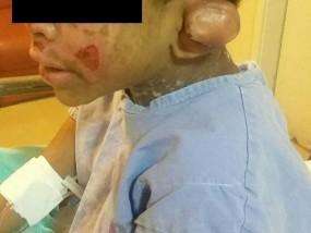 Menino de quatro anos torturado pelos tios e primo se recupera bem