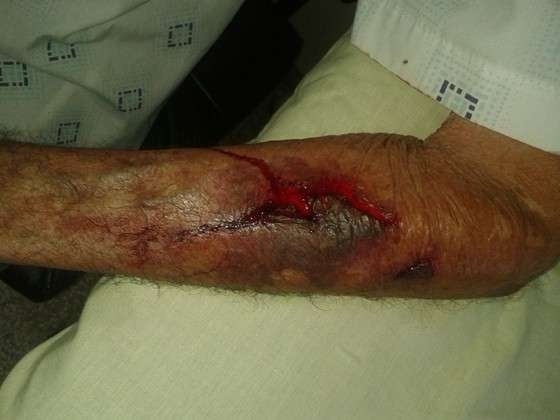 Por dinheiro, filho espanca pai de 90 anos a pauladas e &eacute; preso