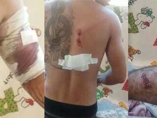 Fotomontagem mostra presos feridos após confronto com a Tropa de Choque, ontem na PED (Foto: Reprodução)