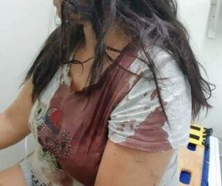 Vítima sangrando foi socorrida pelo Corpo de Bombeiros (Foto: divulgação/Nova Notícias) 