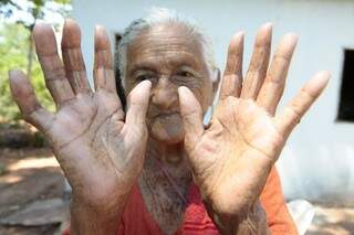 Dona &quot;Gica&quot; mostra as mãos que trouxeram 1.5 mil crianças ao mundo. (Foto: Cleber Gellio)