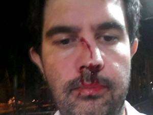 M&eacute;dico &eacute; agredido por colega de profiss&atilde;o dentro de hospital em MS