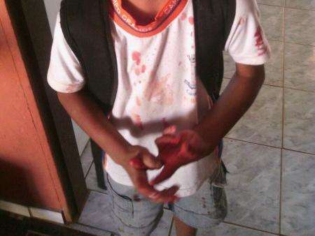 Menino de 9 anos agride estudante de 7 e o deixa &quot;coberto de sangue&quot;