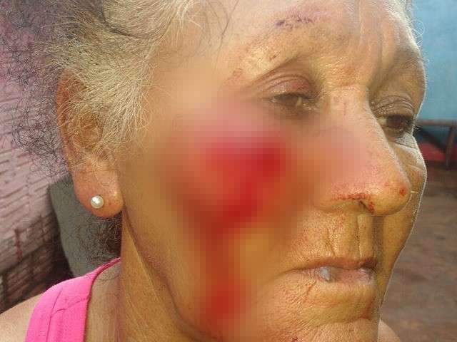 Mulher &eacute; presa em flagrante ap&oacute;s bater e ferir rosto da m&atilde;e com cabo de rodo