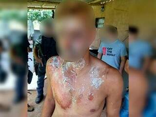 Autor do sequestro foi queimado com água quente (Foto: Direto das Ruas)