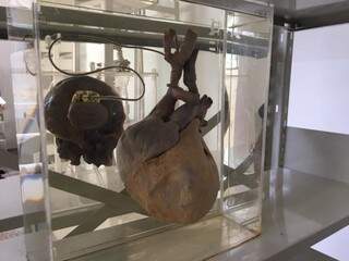 Órgão humano em exposição acervo do Museu de Anatomia da UFMS. (Foto: Divulgação) 
