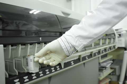 Laboratório faz teste de chikungunya que fica pronto em duas horas
