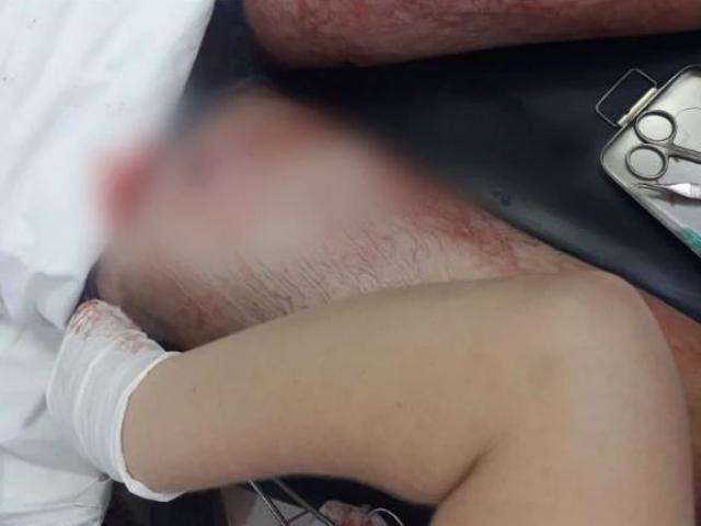 Homem &eacute; baleado durante ataque de mascarados a quadra de esportes 