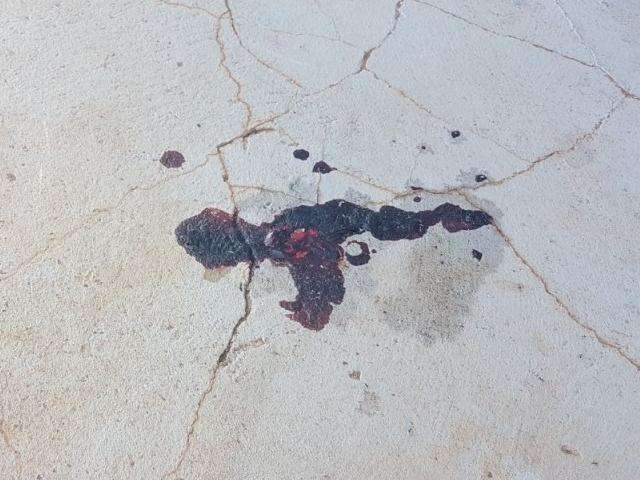 Baleada em tiroteio pode ter alta e ficar com proj&eacute;til alojado ao corpo 