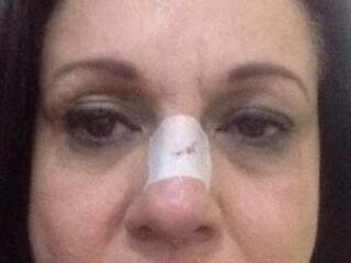 Vítima terá que ficar com o curativo no nariz por uma semana. (Foto: Divulgação)