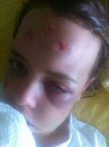 Jovem fala pela 1&ordf; vez &agrave; fam&iacute;lia sobre agress&otilde;es em noite de Rev&eacute;illon 