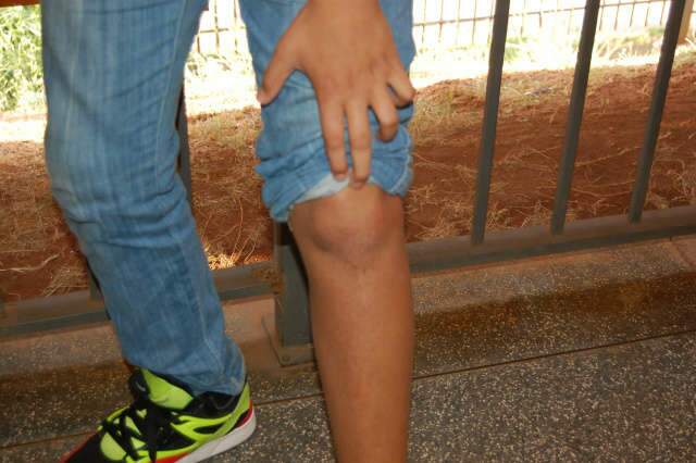  Autores de agress&atilde;o a estudante de 12 anos ser&atilde;o chamados para depor