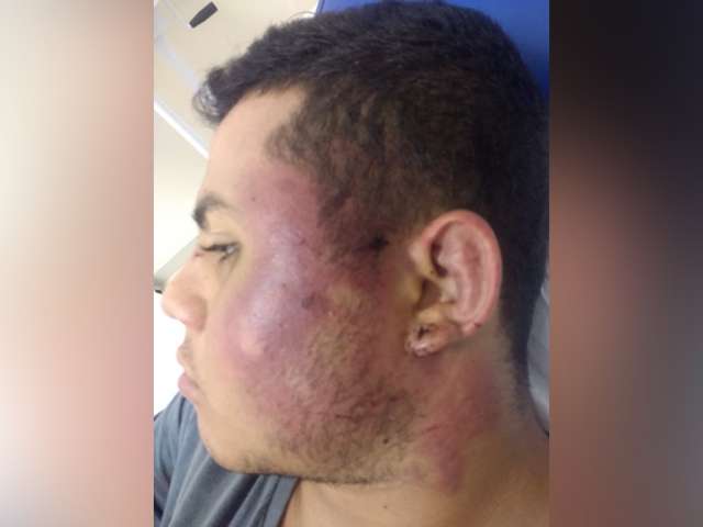 Espancado por ci&uacute;mes, jovem diz que escapou da morte gra&ccedil;as aos vizinhos 