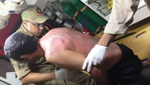 Mulher ateia fogo no marido durante briga em dia de f&uacute;ria