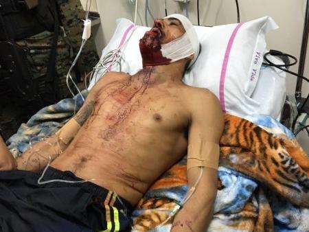 Pistoleiro que matou Rafaat tenta fugir abrindo algema com "medalha santa"