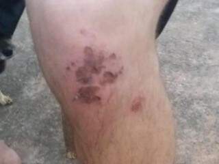 Marcas no joelho do rapaz após ter sido espancado. (Foto: Direto das Ruas) 