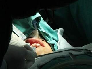 A cirurgia de Rubens foi a primeira realizada no Estado para enxerto ósseo em paciente com lábio leporino. (Foto: Edemir Rodrigues) 