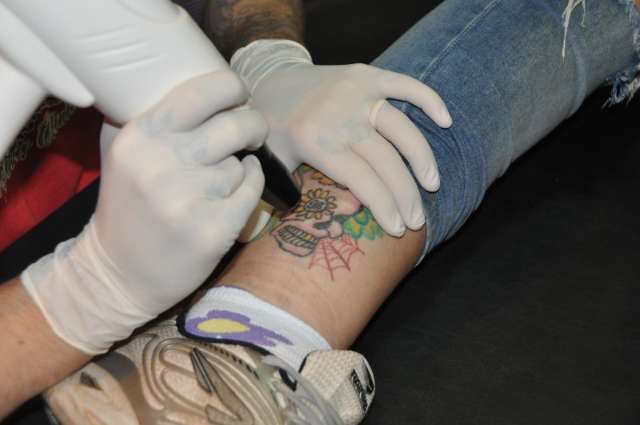 Veja 3 motivos que mais levam pessoas a apagar tatuagens e quanto custa remover