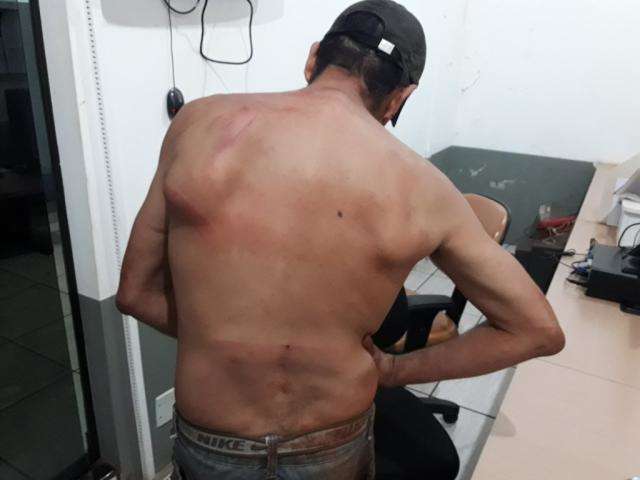 Mulher e atual namorado s&atilde;o agredidos a facadas e pauladas pelo ex