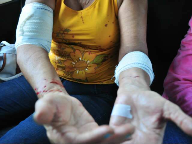  Na frente dos netos, mulher de 61 anos &eacute; atacada por c&atilde;o