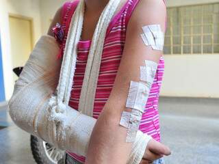 Menina de 11 anos mostra ferimentos feitos pelo ex-namorado da mãe. (Fotos: João Garrigó)