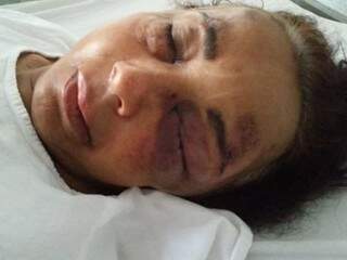 Motociclista que atropelou idosa diz ter cochilado e fugiu com medo de ser preso Motociclista que atropelou idosa diz ter cochilado e fugiu com medo de ser preso