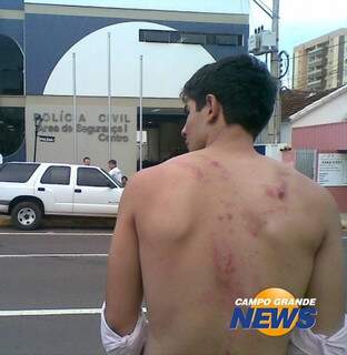 Conforme empresa de segurança, marcas nas costas foram causadas por reação do próprio rapaz. (Foto: Divulgação)