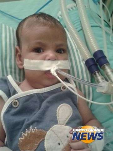 Prefeitura faz locação de aparelho respirador para salvar bebê internado