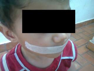 Criança teve a boca colada com fita crepe por funcionária dentro de creche. (Fotos e imagens cedidas por Ronny Viegas e Cláudio Gonçalves)