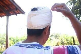 Índio ferido em confronto com os produtores rurais mora a oito quilômetros de Antônio João (Foto: Marcos Ermínio)