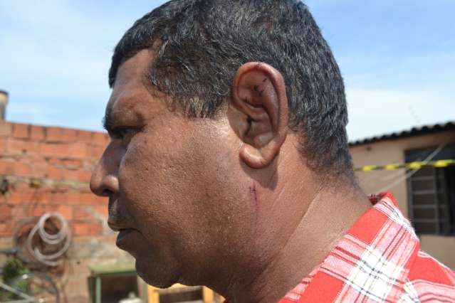 Mulher ateia fogo em resid&ecirc;ncia por n&atilde;o aceitar fim de relacionamento 